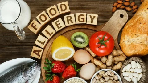 Food Allergies
