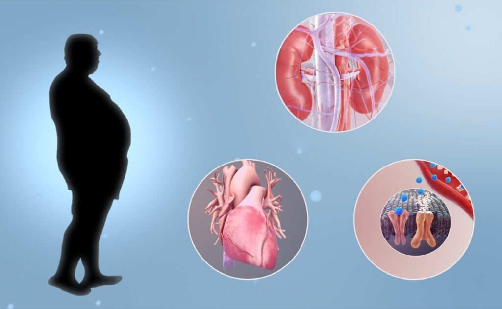 Metabolic Syndrome in Children