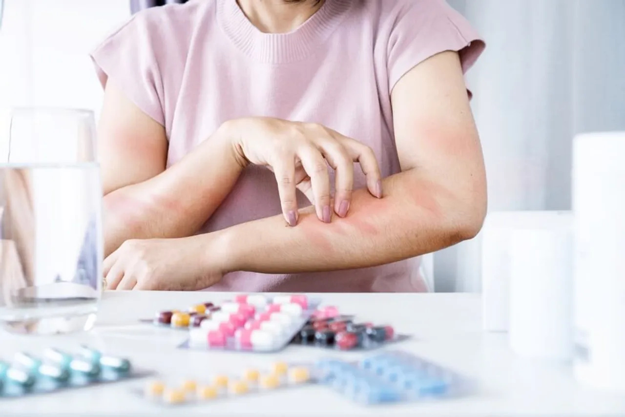 Behavioural Therapies for Anxiety in Children