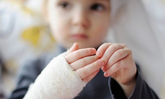 Burns in children