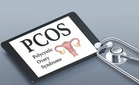 Managing PCOS